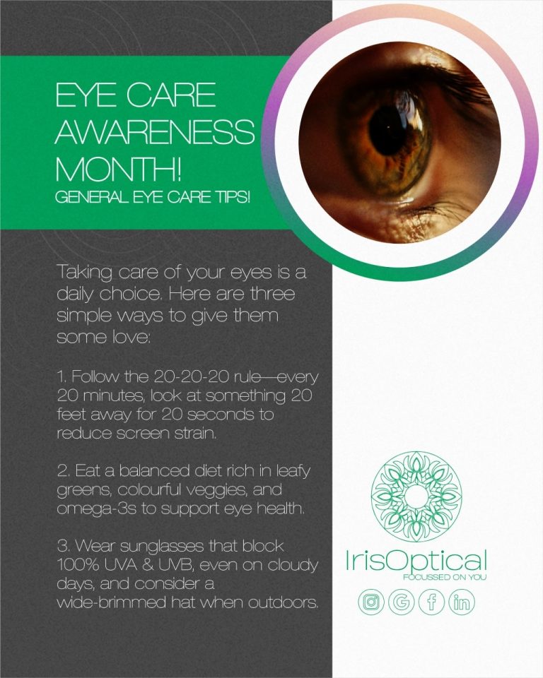 Instagram post from irisopticalza. This post is in position 2.